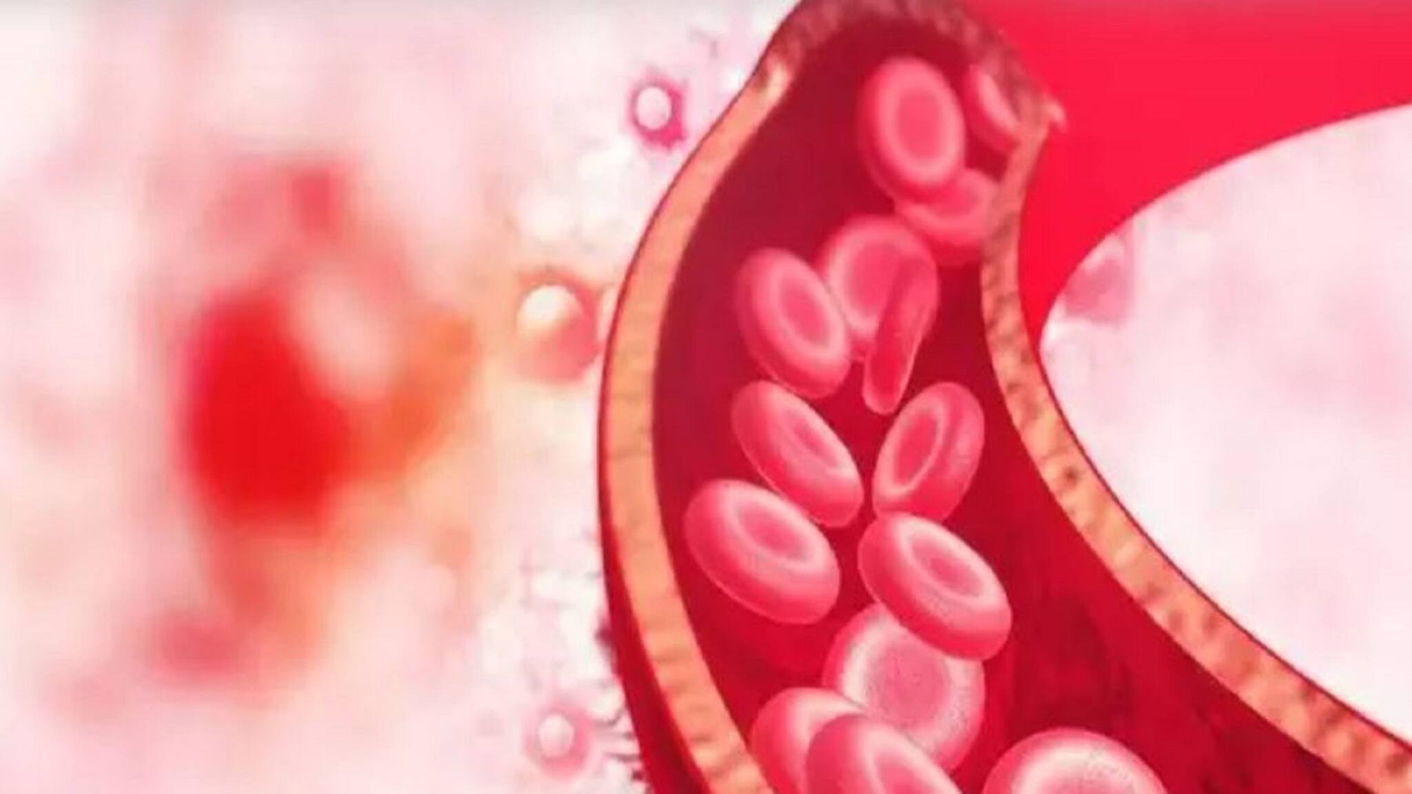 Deep Vein Thrombosis: পায়ে রক্ত জমাট বাঁধলে কী করবেন? জেনে নিন বিশদে