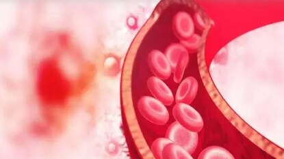 Representative Image Representative Image