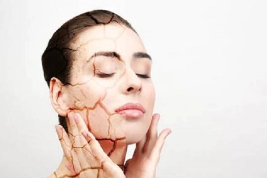 Winter Skin Care: এই সময় ত্বক অস্বাভাবিক শুষ্ক হয়ে যায়