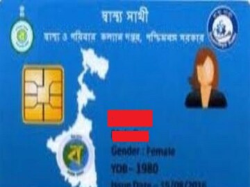 People replaces knee with help of swasthya sathi card