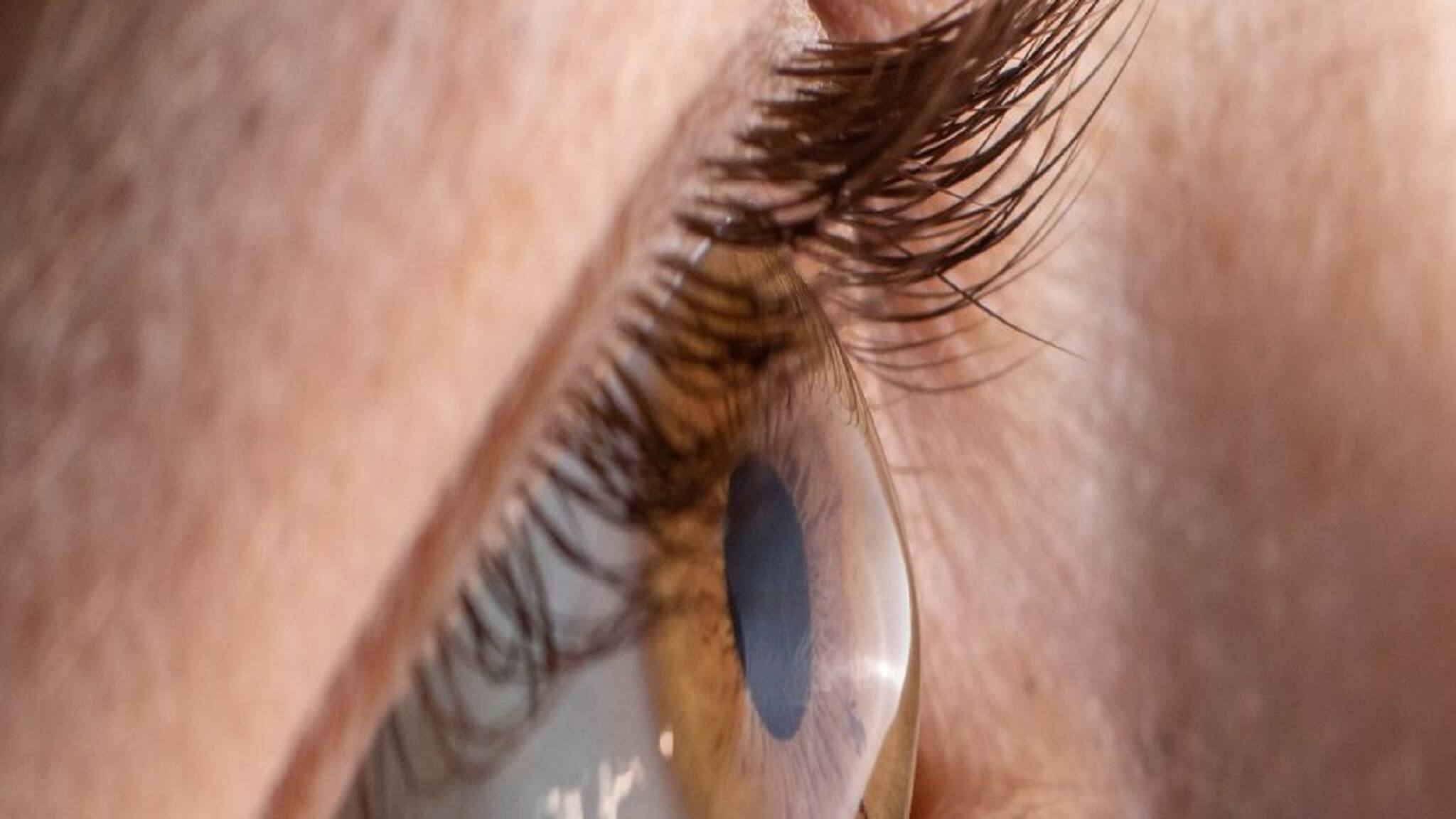 Retinopathy: ডায়াবেটিস রোগীদের মধ্যে ১৬% রেটিনোপ্যাথির শিকার, অন্ধ হয়ে যাওয়ার সম্ভাবনা থাকে ৫% রোগীর, জানাচ্ছেন বিশেষজ্ঞরা