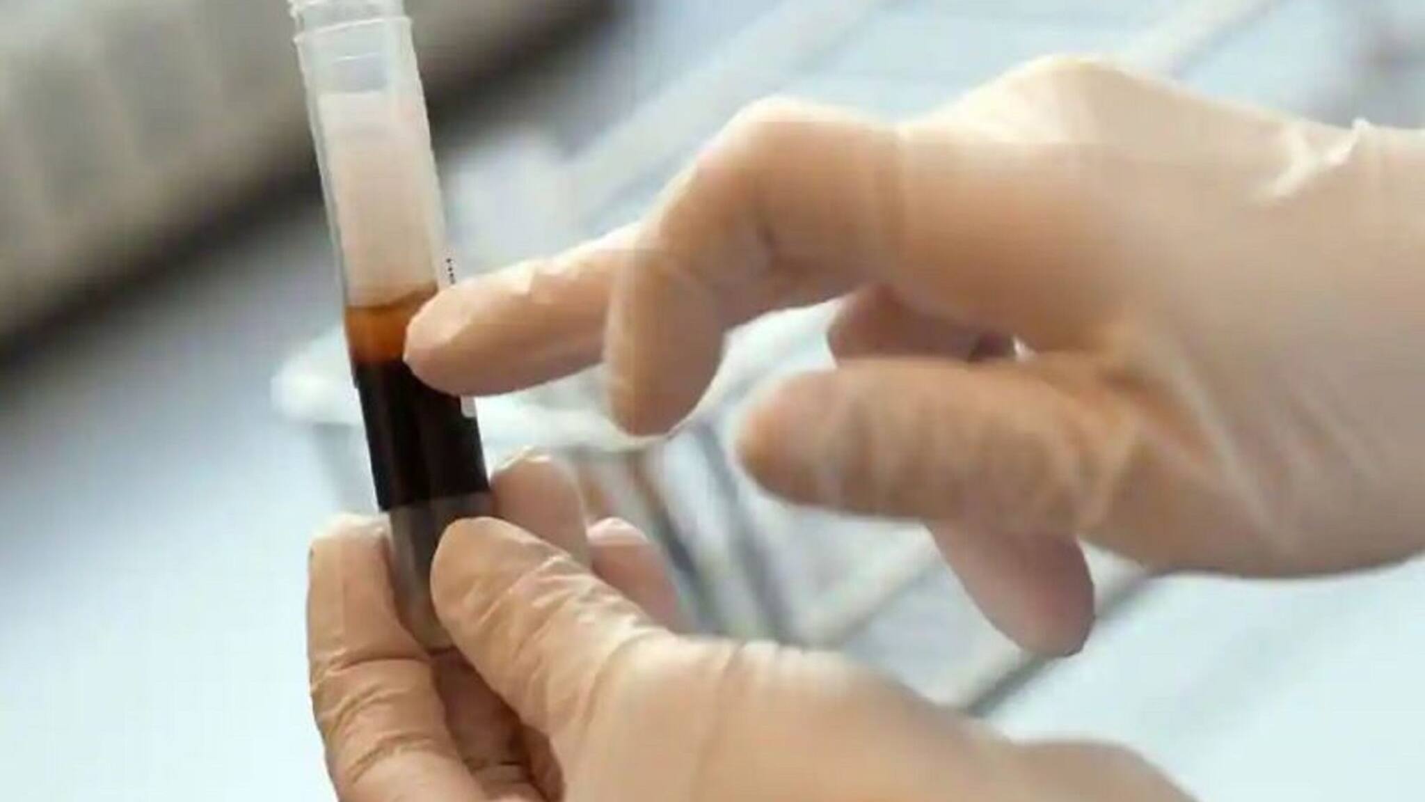 Plasma Therapy: দ্বিতীয় ওয়েভে করোনা রোগীদের সারিয়ে তুলতে ব্যবহার হয়েছে প্লাজমা থেরাপি, এটি কি আদৌ কার্যকরী?