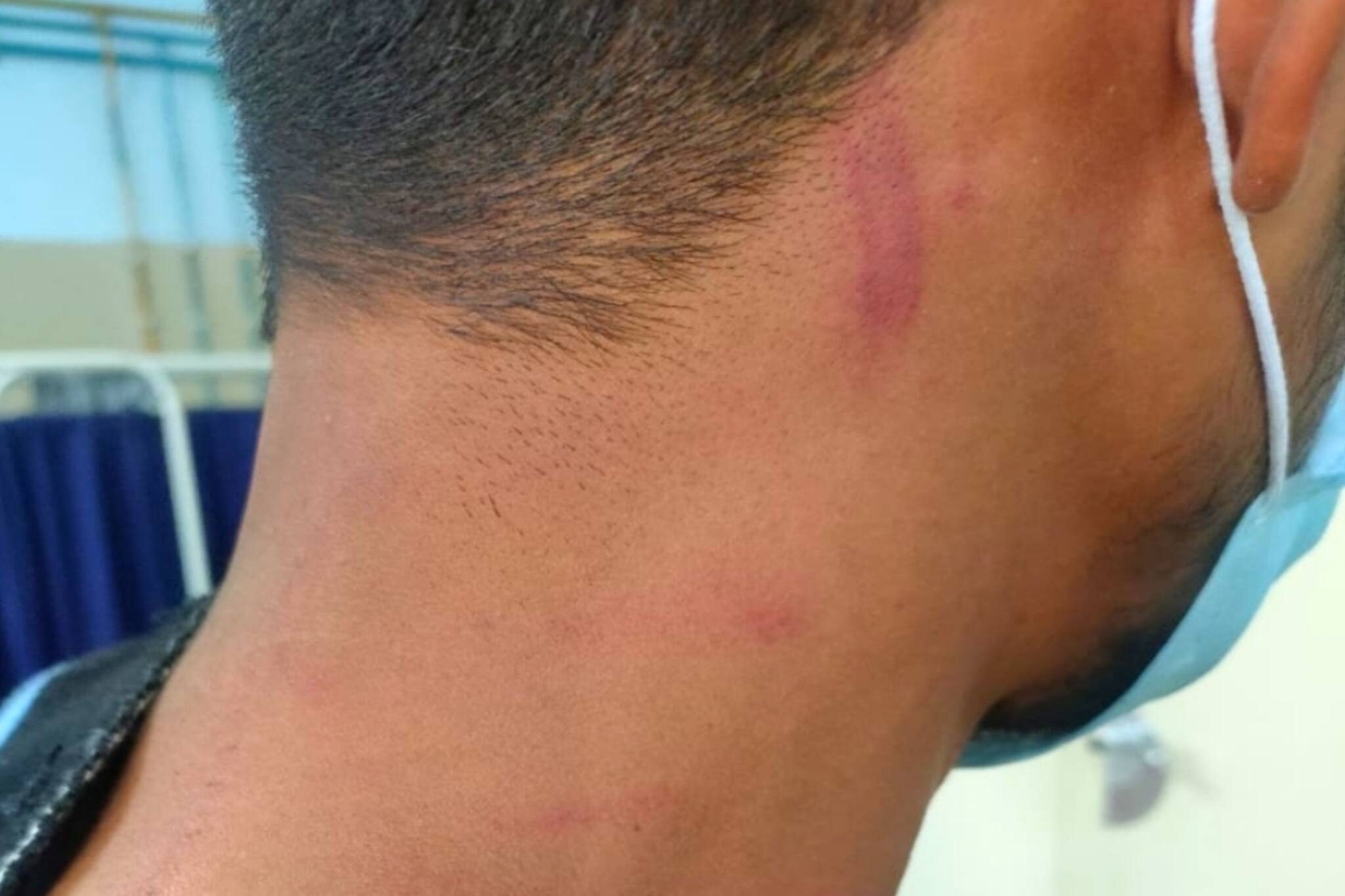 South 24 Parganas: আবার সিভিক ভলেন্টিয়ারের হাতে আক্রান্ত এক যুবক ও যুবতী