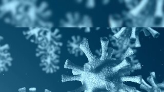 Photo- Representative
Photo- Representative