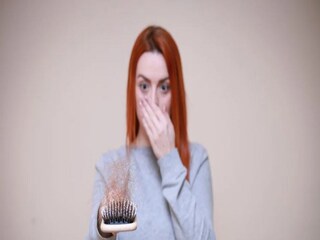 Over Weight: Hair Fall: lesser known signs of underactive thyroid - Photo-Represetative 