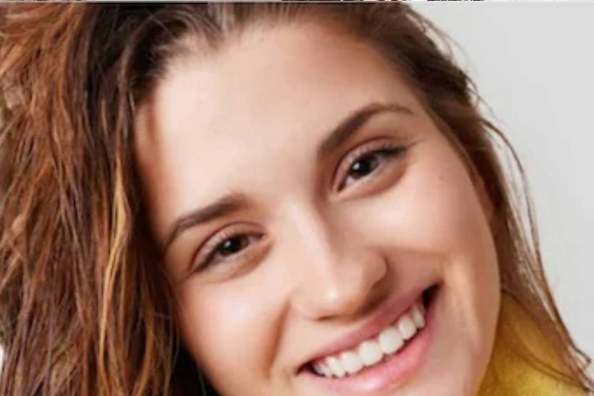 তেল-শ্যাম্পু-কন্ডিশনারের যত্নের পরও চুল সেই নির্জীব? এ বার হাঁটুন উল্টোপথে