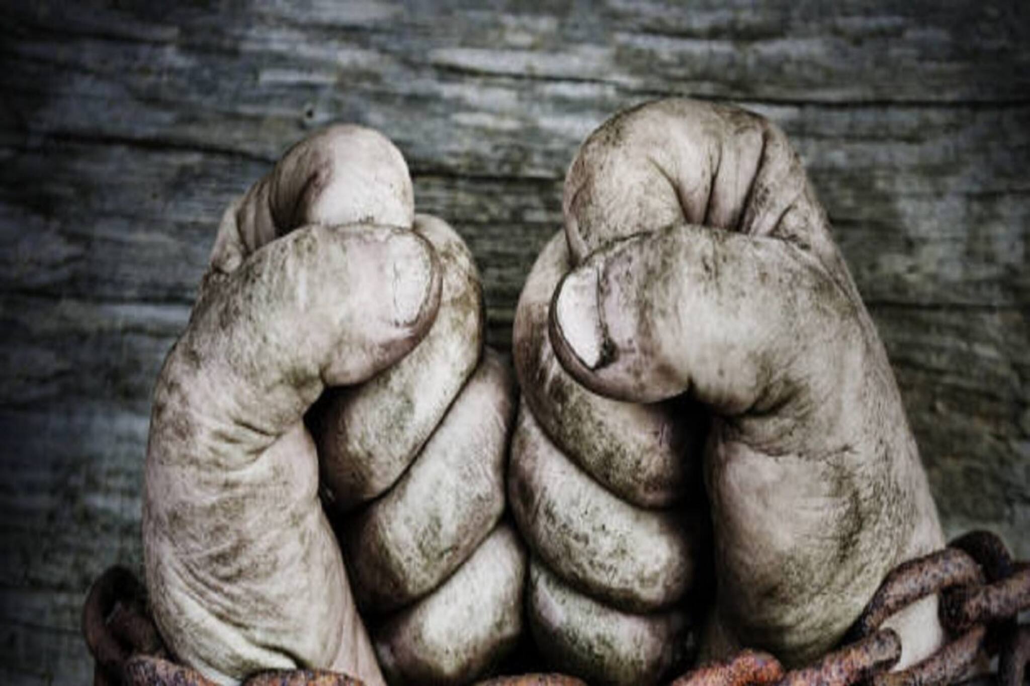 গত ২২ বছর ধরে পায়ে বেড়ি, শিকলে বন্দি, চরম দুর্দশায় মেদিনীপুরের অসহায় যুবক