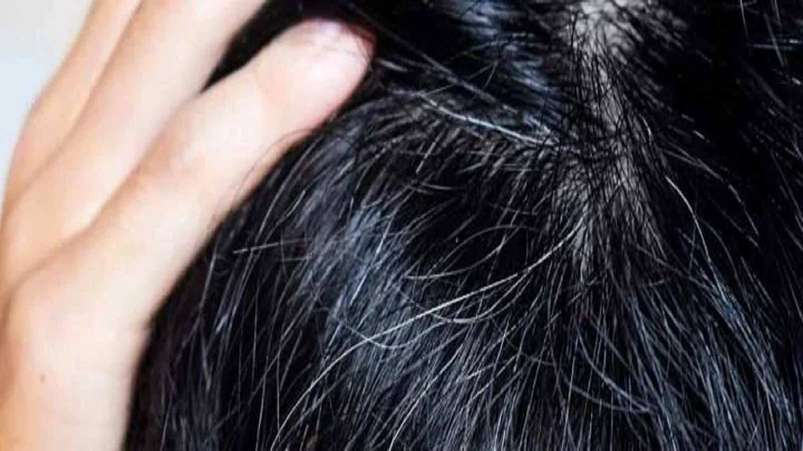 use that mixture it can grey hair turn black again , অল্প বয়সে সাদা