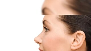 ডার্ক স্পট কম করে
এক টেবিল চামচ বেসন ও এক টেবিল চামচ লেবুর রসের সঙ্গে এক টেবিল চামচ সর্ষের তেল মিশিয়ে মুখে লাগাতে হবে। নিয়মিত এই প্যাক ব্যবহার করলে ডার্ক স্পট ধীরে ধীরে হালকা হয়ে যাবে। ডার্ক স্পট কম করে
এক টেবিল চামচ বেসন ও এক টেবিল চামচ লেবুর রসের সঙ্গে এক টেবিল চামচ সর্ষের তেল মিশিয়ে মুখে লাগাতে হবে। নিয়মিত এই প্যাক ব্যবহার করলে ডার্ক স্পট ধীরে ধীরে হালকা হয়ে যাবে।