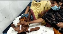 বহরমপুরে বল ভেবে খেলতে গিয়ে বোমা ফেটে আহত তিন কিশোর।