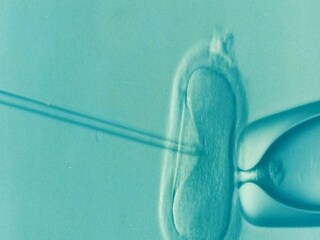 egg freezing at the age of 30-40 years, Know benifits and risk- Photo- Reppresentative 