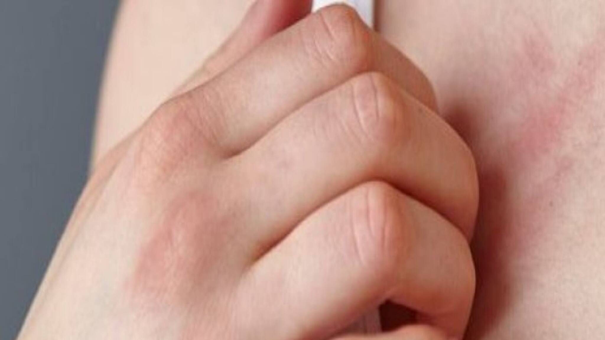 Omicron Symptoms: ওমিক্রনের উপসর্গ প্রকাশ ত্বকেও? জেনে নিন কী কী লক্ষণ থাকলে হতে পারে ওমিক্রন! জানুন ও সতর্ক থাকুন...