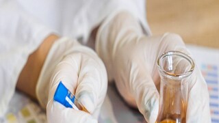 প্রতীকী ছবি৷ 