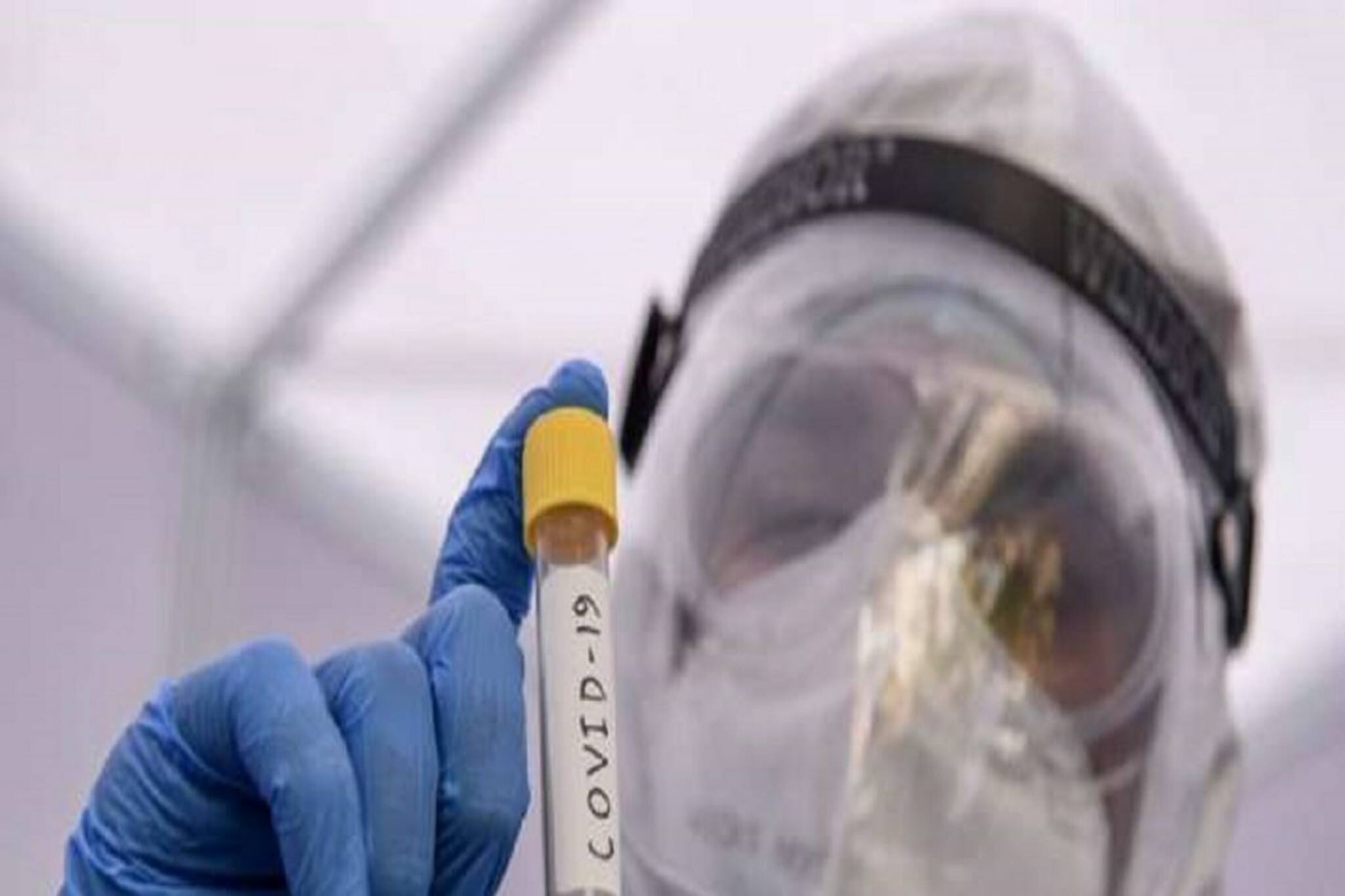 করোনা টেস্টের নামে মহিলার গোপনাঙ্গের সোয়াব সংগ্রহ ল্যাবকর্মীর! তার পর যা হল...