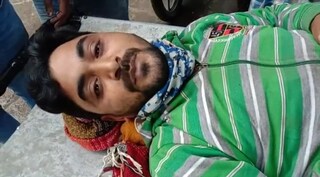 ডোমকলে বোমাবাজিতে আহত ব্যাক্তিকে 