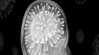 মস্তিষ্কে রক্তক্ষরণ অথবা রক্ত চলাচল বন্ধ হওয়া-সাধারণত এই দুই অবস্থাকে স্ট্রোকের আওতায় ফেলা হয়। শুরুতেই যদি এই সমস্যার লক্ষণগুলো চিহ্নিত করা সম্ভব হয় চিকিৎসার ক্ষেত্রে সুবিধা হয়। মস্তিষ্কে রক্তক্ষরণ অথবা রক্ত চলাচল বন্ধ হওয়া-সাধারণত এই দুই অবস্থাকে স্ট্রোকের আওতায় ফেলা হয়। শুরুতেই যদি এই সমস্যার লক্ষণগুলো চিহ্নিত করা সম্ভব হয় চিকিৎসার ক্ষেত্রে সুবিধা হয়।