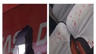 বোমা বিষ্ফোরণে রক্তাক্ত ব্রাজিল ফুটবল