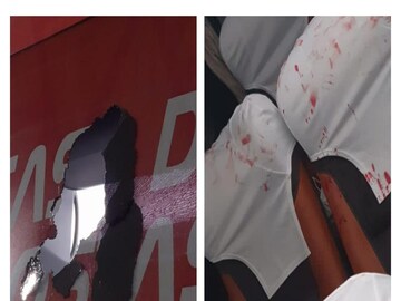 বোমা বিষ্ফোরণে রক্তাক্ত ব্রাজিল ফুটবল