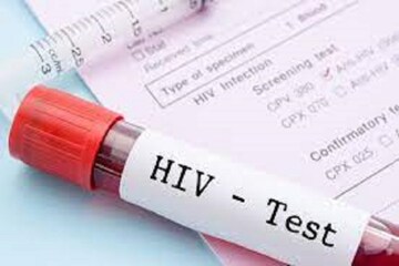 AIDS-এর বিরুদ্ধে চিকিৎসকদের বিরাট সাফল্য! প্রথম মহিলা সম্পূর্ণ HIV মুক্ত
