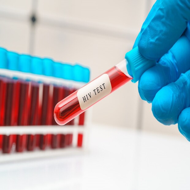 স্টেমসেল (Stem Cell) এমন এক ব্যক্তি দান করেছেন যাঁর শরীরে এইচআইভির বিরুদ্ধে লড়ার জন্য প্রাকৃতিক ক্ষমতা আছে ৷ প্রতীকী ছবি ৷