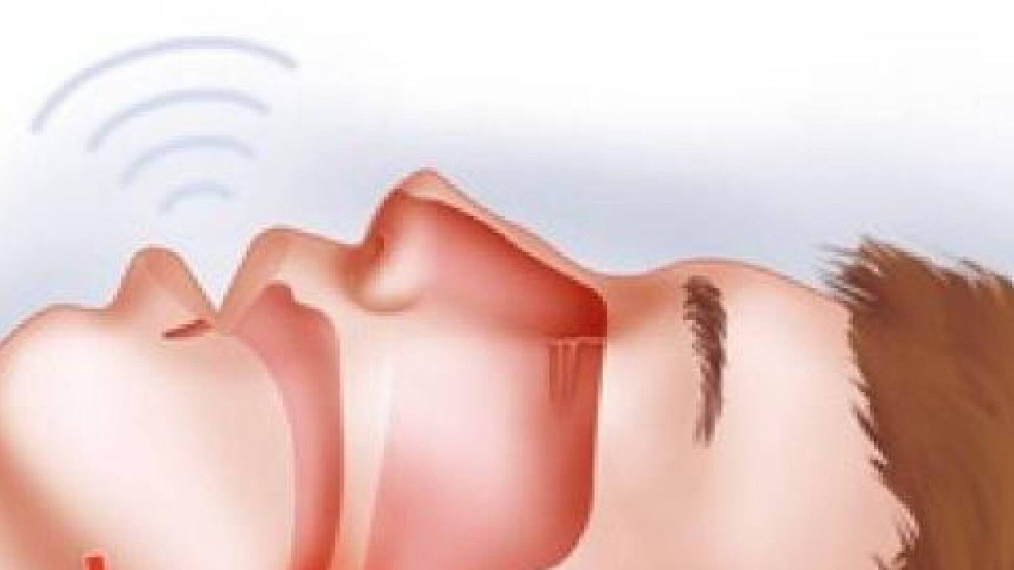 Explained: বাপ্পি লাহিড়ির মৃত্যুর পর শিরোনামে ‘অবস্ট্রাকটিভ স্লিপ অ্যাপনিয়া’, কতটা বিপজ্জনক এই রোগ?