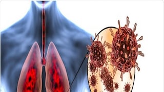 কুইন্সল্যান্ড বিশ্ববিদ্যালয়ের মাইক্রোবায়োলজির অধ্যাপক, পল গ্রিফিন একটি গবেষণায় উল্লেখ করেছেন, কোভিড -19 একটি আরএনএ ভাইরাস যা মিউটেশন করার সময় অনেক ভুল করে। যেহেতু এই ভাইরাস এই ভুলগুলি সংশোধন করতে পারে না, তাই সেই ভুলগুলি ক্রমাগত বিকশিত হয়। মিউটেশনের ফলে যখন ভাইরাসের জেনেটিক কোড পরিবর্তিত হয়, তখন এটি আরও একটি উপ ভ্য়ারিয়েন্ট হিসাবে চিহ্নিত হয়ে যায়। কুইন্সল্যান্ড বিশ্ববিদ্যালয়ের মাইক্রোবায়োলজির অধ্যাপক, পল গ্রিফিন একটি গবেষণায় উল্লেখ করেছেন, কোভিড -19 একটি আরএনএ ভাইরাস যা মিউটেশন করার সময় অনেক ভুল করে। যেহেতু এই ভাইরাস এই ভুলগুলি সংশোধন করতে পারে না, তাই সেই ভুলগুলি ক্রমাগত বিকশিত হয়। মিউটেশনের ফলে যখন ভাইরাসের জেনেটিক কোড পরিবর্তিত হয়, তখন এটি আরও একটি উপ ভ্য়ারিয়েন্ট হিসাবে চিহ্নিত হয়ে যায়।