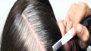 photo source collected 