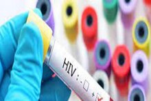 AIDS-এর বিরুদ্ধে চিকিৎসকদের বিরাট সাফল্য! প্রথম মহিলা সম্পূর্ণ HIV মুক্ত