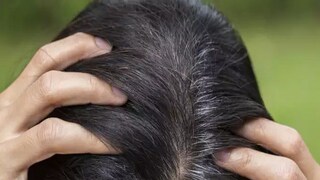 চুল পাকতে শুরু করলে ঘাবড়ে যাবেন না। কারণ মাত্র একটু ক্যস্টর অয়েলেই সমস্যা মিটতে পারে। তাই পাকা চুল দেখলেই নিয়ম করে ক্যাস্টর অয়েল লাগান। এটি চুলের রং ধরে রাখে। চুল পাকতে শুরু করলে ঘাবড়ে যাবেন না। কারণ মাত্র একটু ক্যস্টর অয়েলেই সমস্যা মিটতে পারে। তাই পাকা চুল দেখলেই নিয়ম করে ক্যাস্টর অয়েল লাগান। এটি চুলের রং ধরে রাখে।