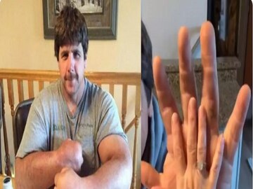 Viral Video