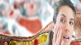 উচ্চ কোলেস্টেরলের উপসর্গ:
হাই কোলেস্টেরলের (High Cholesterol) যদিও সেরকম কোনও উপসর্গ (Symptoms) দেখা যায় না। যদিও এই রোগের চিকিৎসা সময়ে না-হয়, তা-হলে সেটা থেকে অ্যাথেরোস্ক্লেরোসিস হতে পারে। এই রোগের ক্ষেত্রে প্লাক জমতে জমতে ধমনী অবরুদ্ধ হয়ে পড়ে। যার ফলে হাত এবং পায়ে রক্ত চলাচল ব্যাহত হতে পারে। আর এই অবস্থাকে পেরিফেরাল আর্টেরিয়াল ডিজিজ (PAD) বলা হয়। আর এই রোগ থাকলে হাঁটাচলার সময় পায়ে এবং কাজ করার সময় হাতে প্রচণ্ড ব্যথা অনুভূত হয়। এর উপসর্গের মধ্যে অন্যতম: উচ্চ কোলেস্টেরলের উপসর্গ:
হাই কোলেস্টেরলের (High Cholesterol) যদিও সেরকম কোনও উপসর্গ (Symptoms) দেখা যায় না। যদিও এই রোগের চিকিৎসা সময়ে না-হয়, তা-হলে সেটা থেকে অ্যাথেরোস্ক্লেরোসিস হতে পারে। এই রোগের ক্ষেত্রে প্লাক জমতে জমতে ধমনী অবরুদ্ধ হয়ে পড়ে। যার ফলে হাত এবং পায়ে রক্ত চলাচল ব্যাহত হতে পারে। আর এই অবস্থাকে পেরিফেরাল আর্টেরিয়াল ডিজিজ (PAD) বলা হয়। আর এই রোগ থাকলে হাঁটাচলার সময় পায়ে এবং কাজ করার সময় হাতে প্রচণ্ড ব্যথা অনুভূত হয়। এর উপসর্গের মধ্যে অন্যতম: