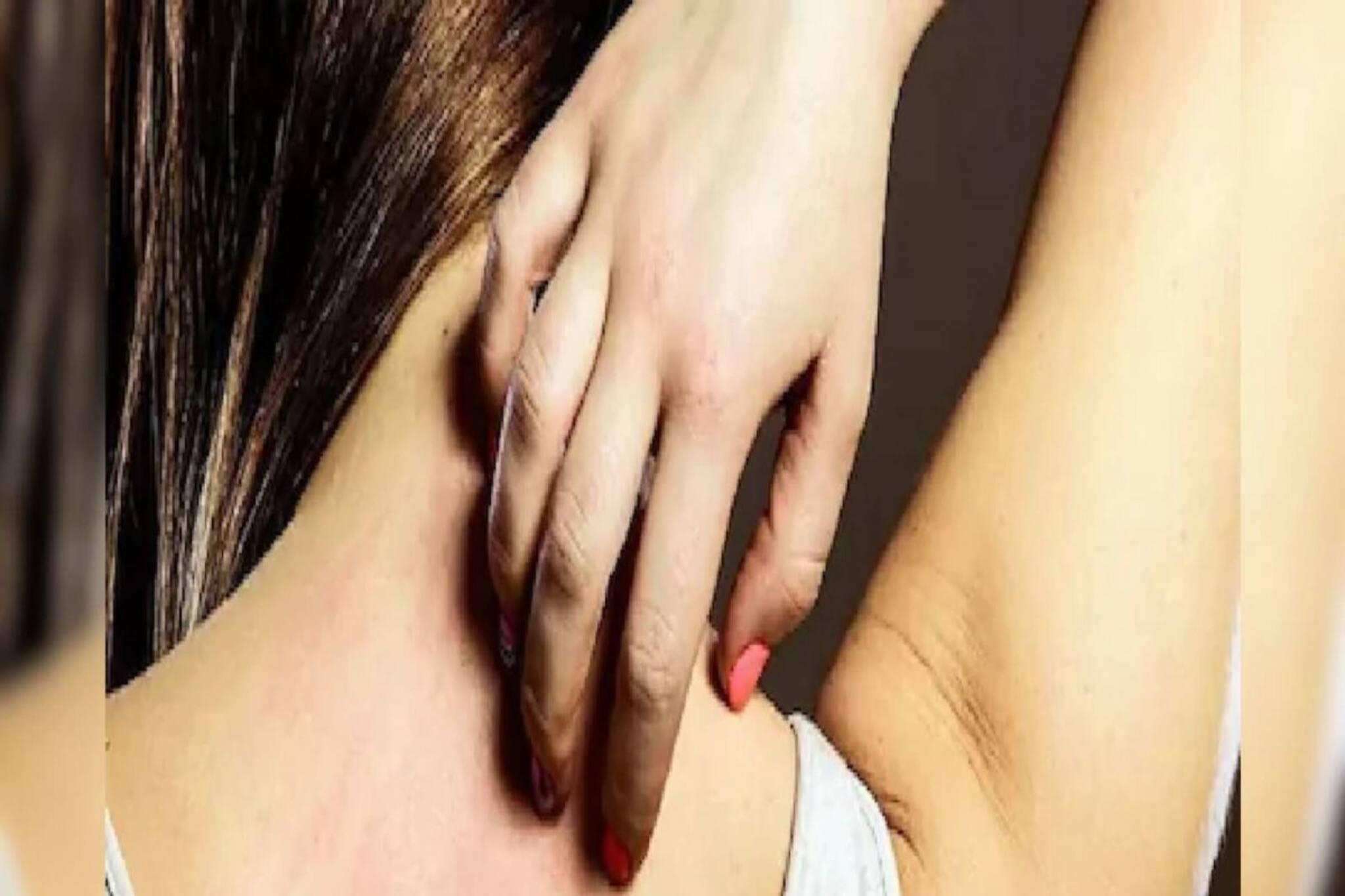 গরম মানেই তীব্র চুলকানিতে ওষ্ঠাগত প্রাণ? রইল সহজ সমাধান