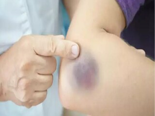 কী হতে পারে?