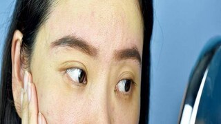 ত্বকের উজ্জ্বলতা কমতে থাকলে আন্দাজ করতে পারেন, শরীরে ভিটামিন বি১২-এর অভাব দেখা দিয়েছে। এই ভিটামিনের অভাবে ত্বক খারাপ হতে থাকে। এছাড়া শরীরে সারা দিন ক্লান্তি বোধ থাকবে। জিভে খাবারের কোনও স্বাদও পাবেন না। ভিটামিন বি১২ এর পরিমাণ ঠিক রাখতে স্যালমন ফিশ, রেড মিট, দই ও চিজ খান।   