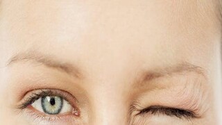 চোখ লাফানো (Eye twitching): ডান চোখ লাফানো মানেই ছেলেদের জন্য শুভ আর বাম চোখ লাফানো মানেই মেয়েদের জন্য শুভ, এমনটাই বিশ্বাস হয়ে 

আসছে। যদিও এর কোনও ভিত্তি নেই। সাধারণত চোখের পাতার পেশির ক্লান্তির কারণেই এটা হয়ে থাকে।