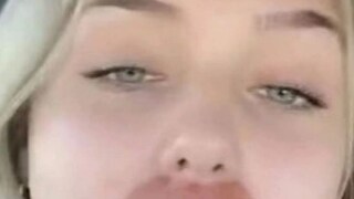 ৫০ হাজারেরও বেশি টাকা গেল জলে, সৌন্দর্যবৃদ্ধির বদলে মুখে এখন বানরের মতো কালো দাগ! ৫০ হাজারেরও বেশি টাকা গেল জলে, সৌন্দর্যবৃদ্ধির বদলে মুখে এখন বানরের মতো কালো দাগ!