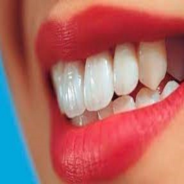 এই ব্যাকটেরিয়া শুরু দাঁতে ক্যাভেটি বা খতের সৃষ্টি করে তাই নয়, মাড়িও দুর্বল করে ৷ কোনও খাওয়া দাওয়া না করলেও জ্বলন সৃষ্টি হয় ৷ ফলত কোনও কিছু খেতে গেলেই সমস্যার সম্মুখীন হতে হয় ৷ নিশ্বাসে দুর্গন্ধ জন্মায় ৷ প্রতীকী ছবি ৷