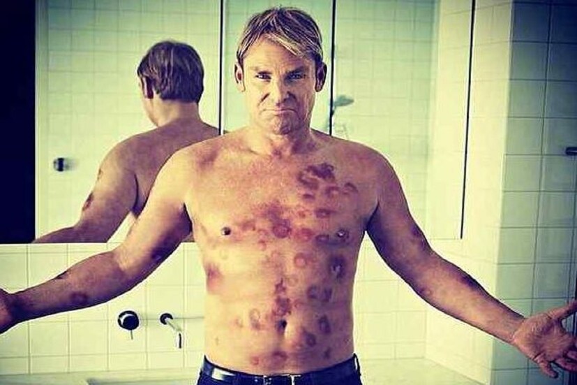 Shane Warne Drug case- এছাড়াও ড্রাগ নেওয়ার জন্য ক্রিকেট থেকে নির্বাসিত হন৷ ড্রাগ টেস্টে শেন ওয়ার্নের মূত্রে নিষিদ্ধ ড্রাগের নমুনা পান৷  Photo- Collected 