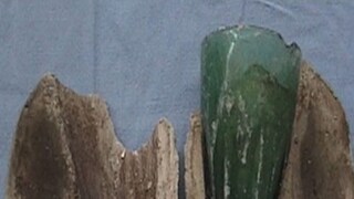 গোপনাঙ্গ থেকে বেরল আস্ত কাচের গ্লাস, হতবাক চিকিৎসক, তোলপাড় সোশ্যাল মিডিয়া