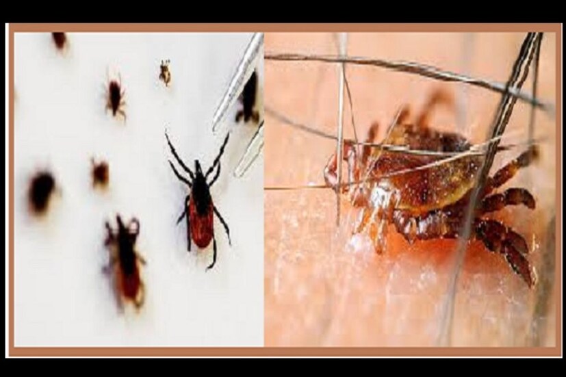মারণ ভাইরাস করোনা বুঝিয়ে দিয়েছে কী ভাবে মুহূর্তে শেষ হয়ে যায় জনজীবন এক ভাইরাসের কবলে। কী ভাবে মৃত্যুমিছিল জীবনকে নিয়ন্ত্রণ করে গোটা বিশ্বজুড়ে। এরইমধ্যে গোটা বিশ্বে গত সপ্তাহের তুলনায় এই সপ্তাহে একলাফে ৮ শতাংশ বেড়ে গিয়েছে সংক্রমণ। নতুন করে করোনার এই রক্তচক্ষুর মধ্য়েই ভয় দেখাচ্ছে আরেক নতুন ভাইরাস (Virus)। ভাইরাসটির নাম হার্টল্যান্ড ভাইরাস (Heartland virus)। ২০০৯ সালে প্রথমবার আমেরিকার (US) মিসৌরিতে এর দেখা মিলেছিল। নতুন করে এবার জর্জিয়ায় দেখা মিলল এই ভাইরাসের। শুধু জর্জিয়া নয়, বেশ কয়েকটি স্টেট থেকেই আসছে এই নতুন ভাইরাস আতঙ্ক।