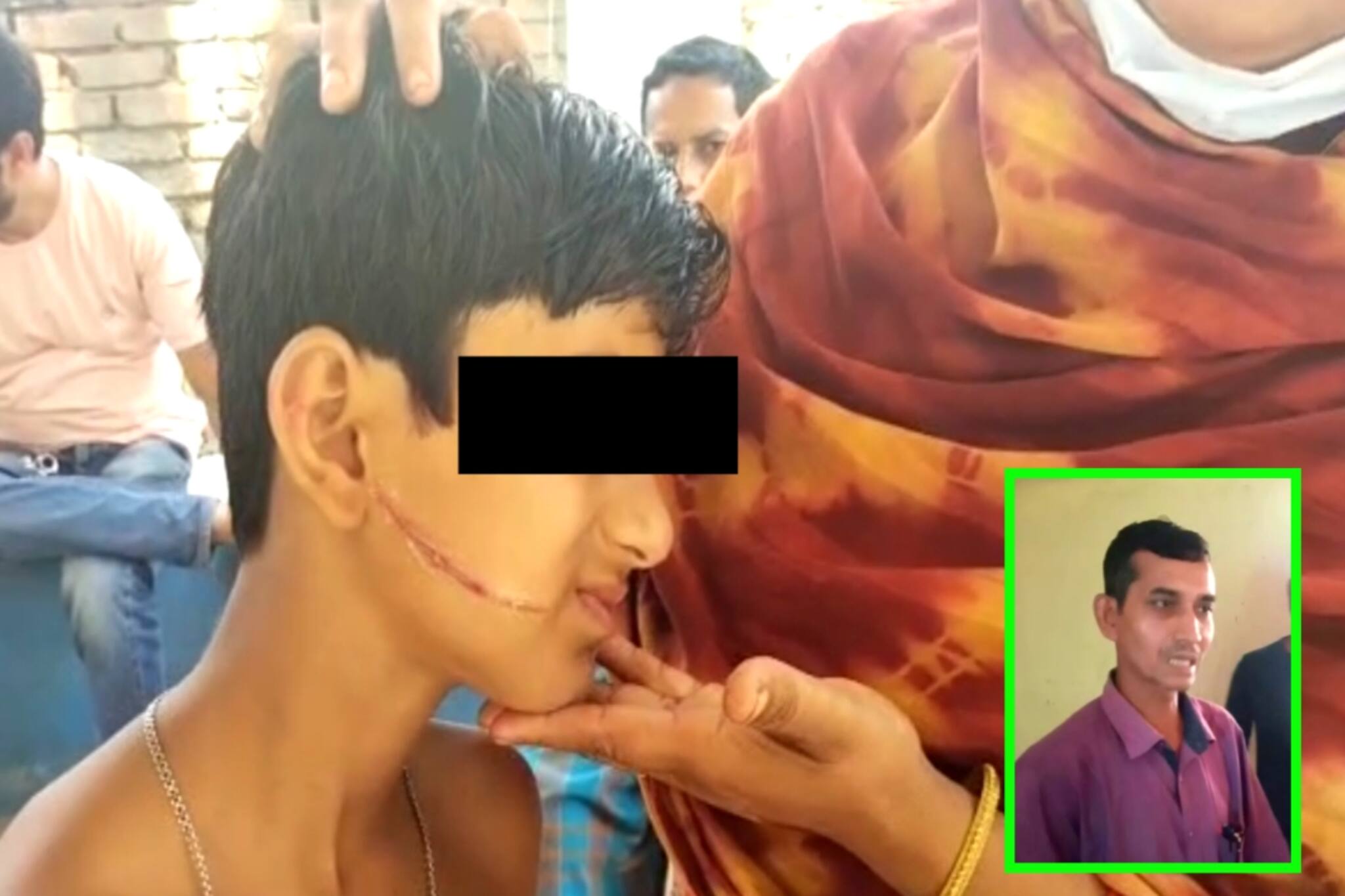 North 24 Parganas: কঞ্চি দিয়ে মেরে ছাত্রের মুখ ফাটালো প্রধান শিক্ষক