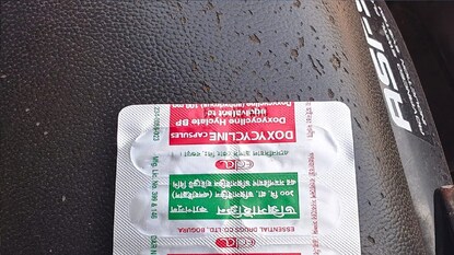 Rx মার্ক: এই ওষুধগুলিও ডাক্তারের পরামর্শের পরেই খাওয়া উচিত তবে এগুলো সাধারণ ওষুধ। Rx মার্ক: এই ওষুধগুলিও ডাক্তারের পরামর্শের পরেই খাওয়া উচিত তবে এগুলো সাধারণ ওষুধ।