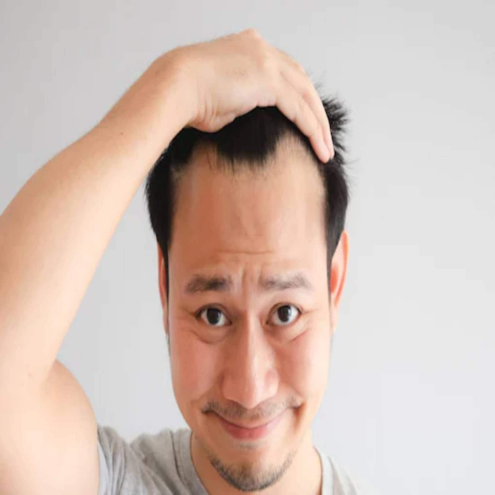 35 Perfect Receding Hairline Haircuts  Hide the Bad Hairline
