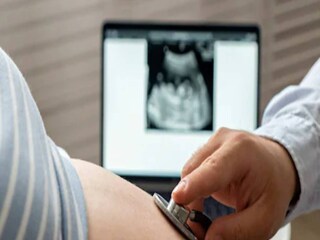 Fertility