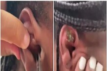 মহিলার কানে ঢুকে গেল জলজ্যান্ত কাঁকড়া! ভাইরাল ভিডিও দেখার আগে সাবধান মহিলার কানে ঢুকে গেল জলজ্যান্ত কাঁকড়া! ভাইরাল ভিডিও দেখার আগে সাবধান