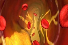 শরীরে Good Cholesterol বৃদ্ধিতে ধূমপান-সহ এই সমস্ত ক্ষতিকারক স্বভাব বর্জন করুন