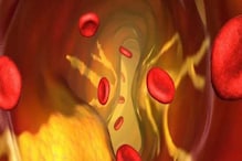 শরীরে Good Cholesterol বৃদ্ধিতে ধূমপান-সহ এই সমস্ত ক্ষতিকারক স্বভাব বর্জন করুন শরীরে Good Cholesterol বৃদ্ধিতে ধূমপান-সহ এই সমস্ত ক্ষতিকারক স্বভাব বর্জন করুন