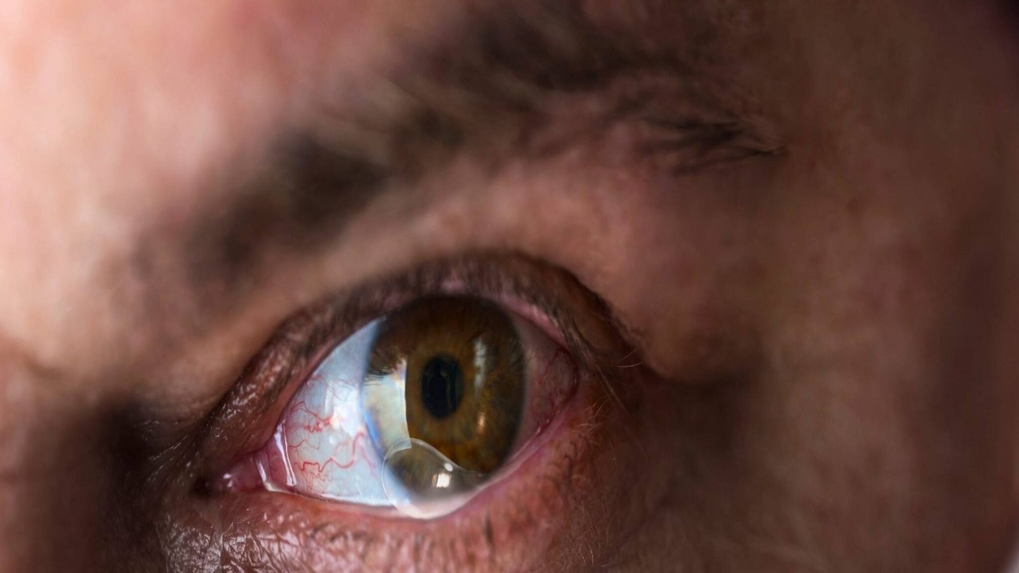 Dry Eyes: Explained: দিনের পর দিন মাস্ক পরায় বাড়ছে চোখের সমস্যা, কীভাবে সুরক্ষিত রাখবেন চোখ?