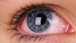  কনট্যাক্ট লেন্স আগে দেখবেন হাতে যাতে কোনও ধরনের মেক আপ বা নোংরা না লেগে থাকে। খোলার সময়েও মাথায় রাখবেন।