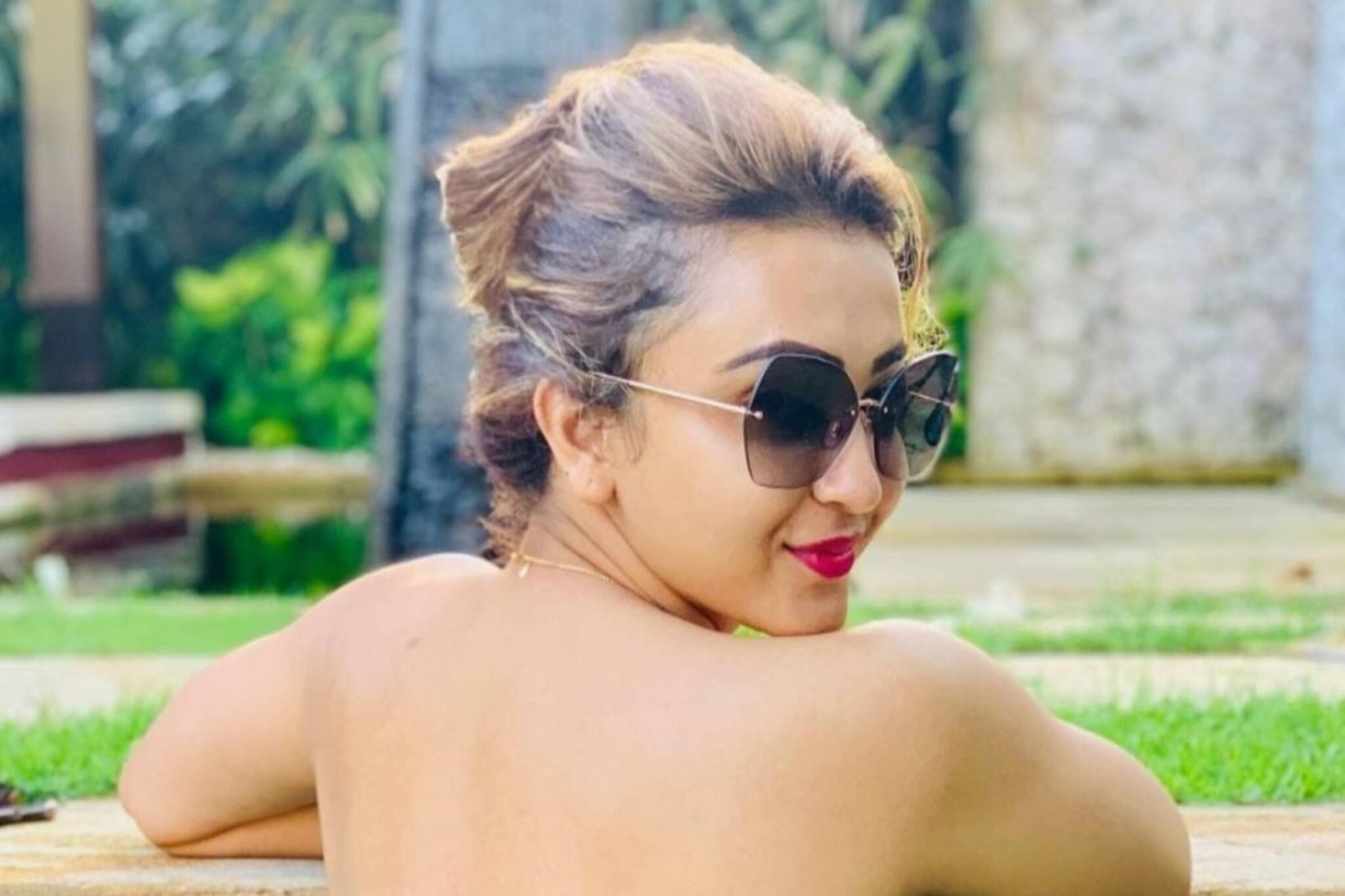 গরমেও ত্বক আর্দ্রতা হারাচ্ছে না তো? দেখে নিন লক্ষণ মিলিয়ে! রইল মুক্তির পথ